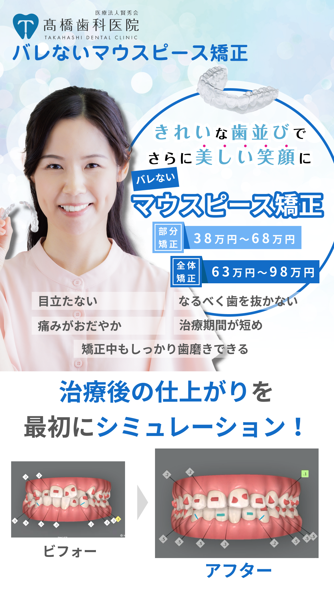 バレないマウスピース矯正